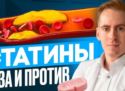 Что такое статины, польза и вред применения Что такое статины, польза и вред применения