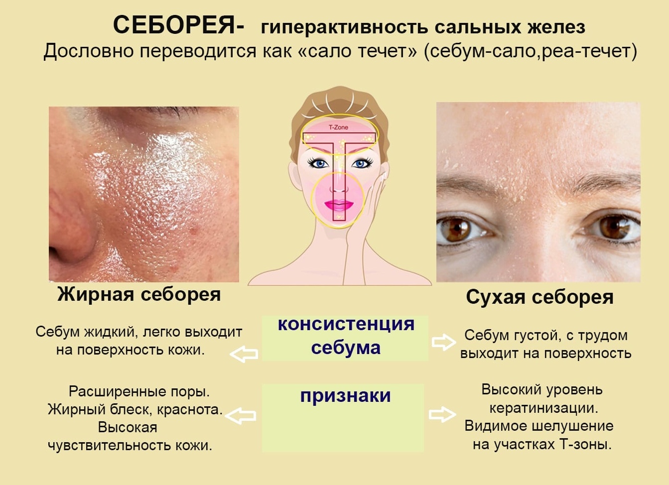 Почему возникает себорея кожи головы и как ее вылечить Почему возникает себорея кожи головы и как ее вылечить