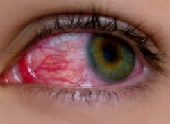 Болезни глаз у человека: названия, фото, информация о симптомах и лечении Болезни глаз у человека: названия, фото, информация о симптомах и лечении