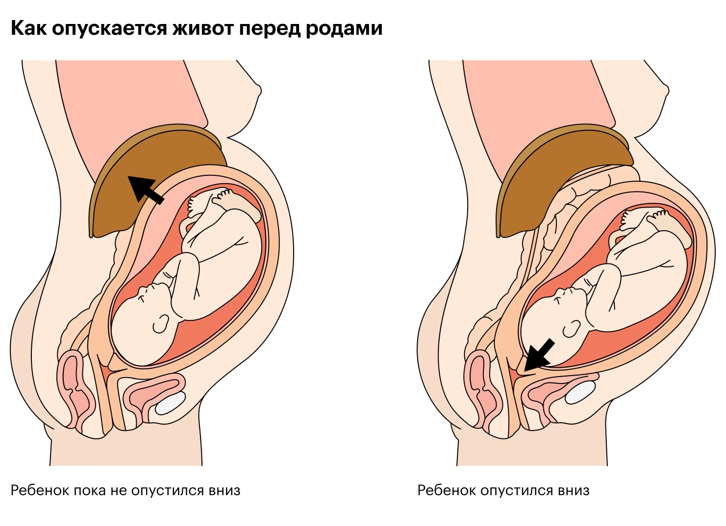 Что происходит на 39 неделе беременности перед вторыми родами Что происходит на 39 неделе беременности перед вторыми родами