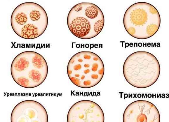 Гонорея у мужчин: формы и симптомы заболевания, способы лечения Гонорея у мужчин: формы и симптомы заболевания, способы лечения
