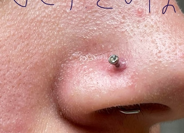 Пирсинг носа: фото, требования к серьгам, отзывы