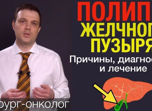 Симптомы и лечение полипоза желчного пузыря