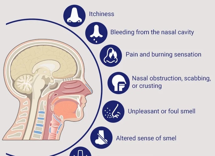 Причины появления и способы устранения сухости во рту Причины появления и способы устранения сухости во рту
