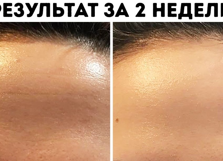 Как сделать кожу лица идеальной в домашних условиях
