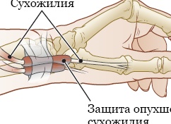 Причины и способы лечения боли в пояснице у мужчин