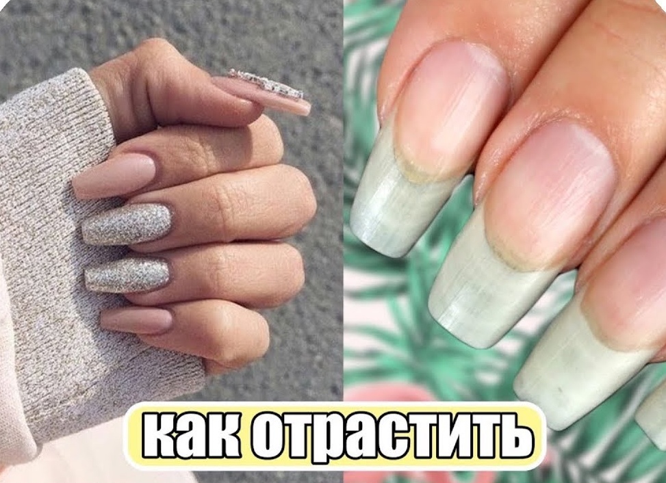 Как отрастить красивые длинные ногти в домашних условиях
