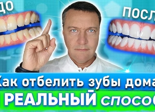 Как безопасно отбелить зубы в домашних условиях Как безопасно отбелить зубы в домашних условиях
