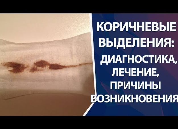 Причины возникновения коричневых выделений в середине цикла