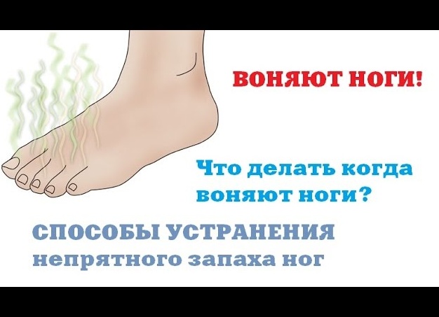 Сильно потеют ноги и воняют: причины, способы решения проблемы Сильно потеют ноги и воняют: причины, способы решения проблемы