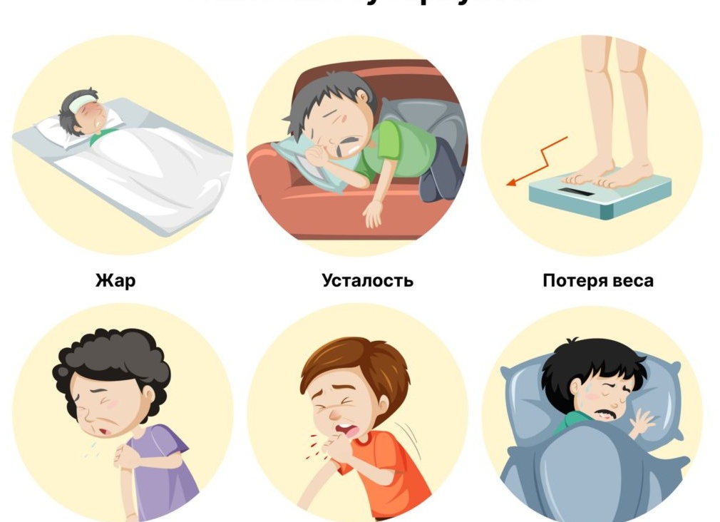 Туберкулез у взрослых: симптомы, первые признаки, методы лечения