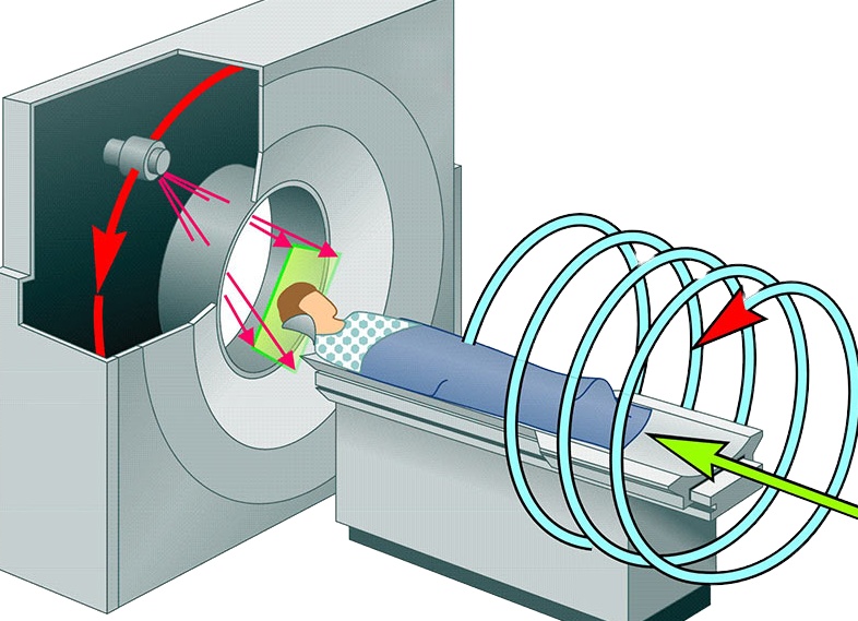 Особенности проведения компьютерной томографии легких