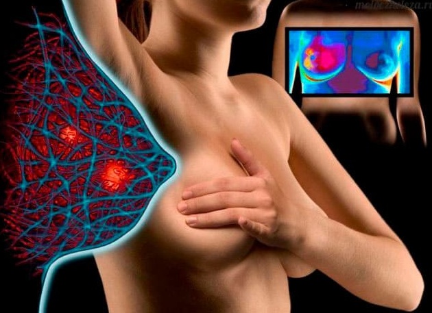 Почему болят соски у мужчин, женщин и детей