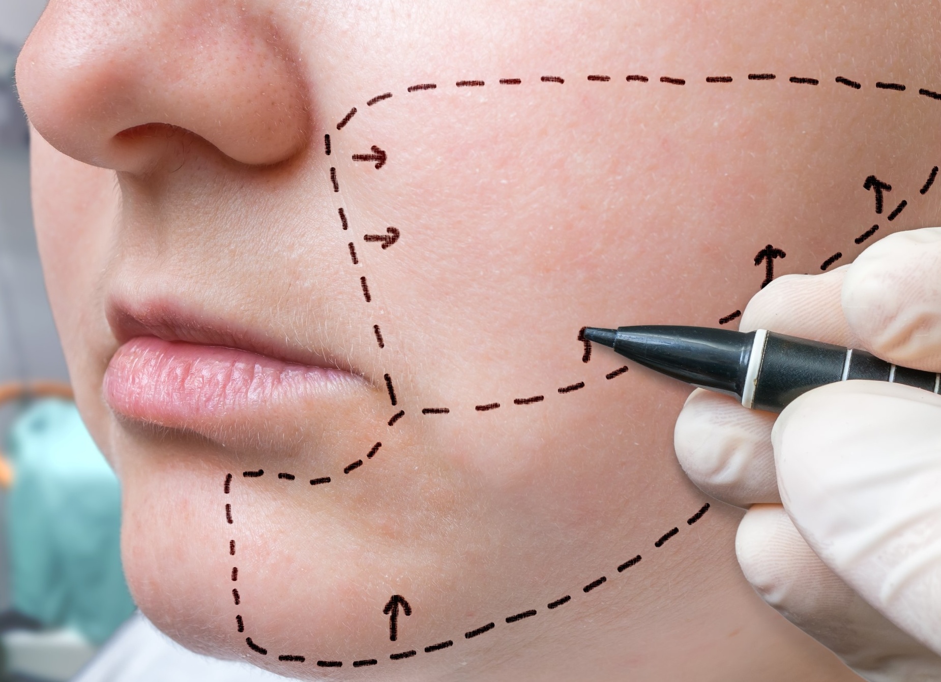 Как убрать пухлые щеки и сделать красивые скулы Как убрать пухлые щеки и сделать красивые скулы