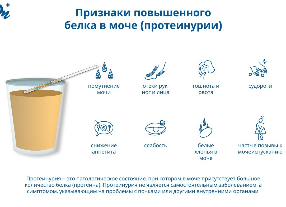 Что означает наличие белка в моче у детей и взрослых Что означает наличие белка в моче у детей и взрослых