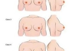 Как выглядит 2 размер бюста: фото и советы по увеличению объема груди