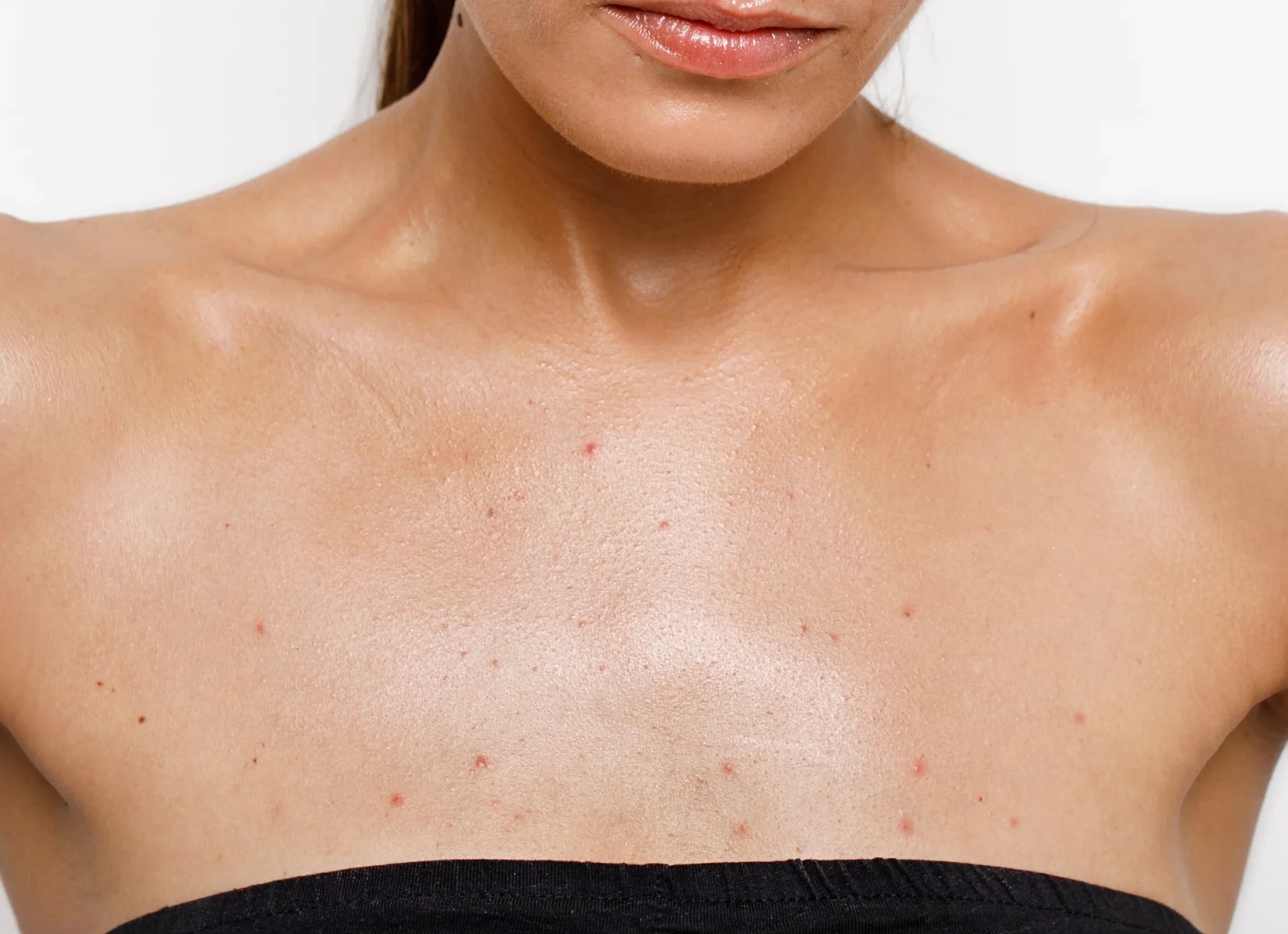 Симптомы кисты в груди, особенности лечения