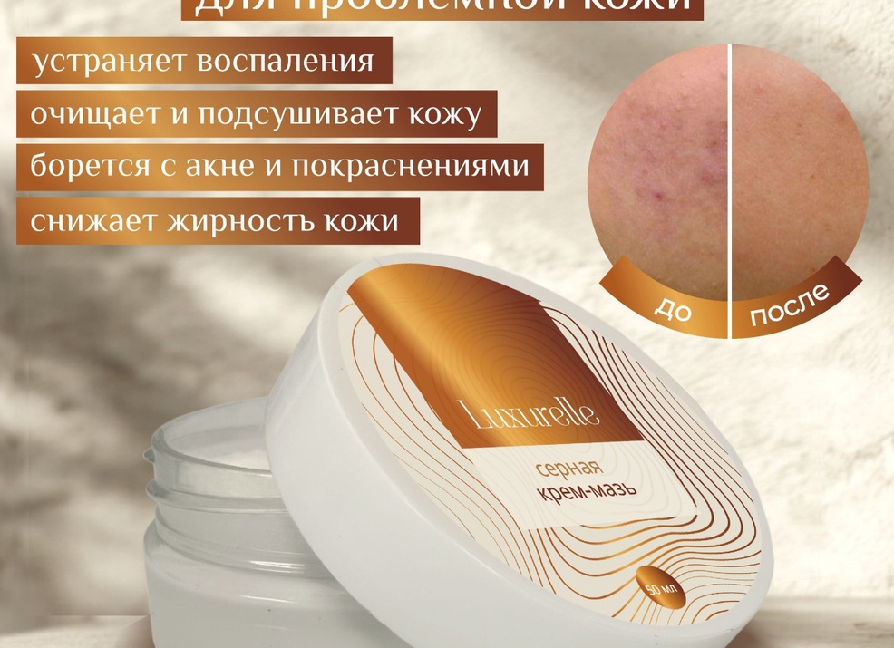 Какую мазь выбрать для лечения чесотки Какую мазь выбрать для лечения чесотки