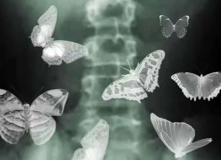 «Бабочки в животе» — что означает это интересное выражение?