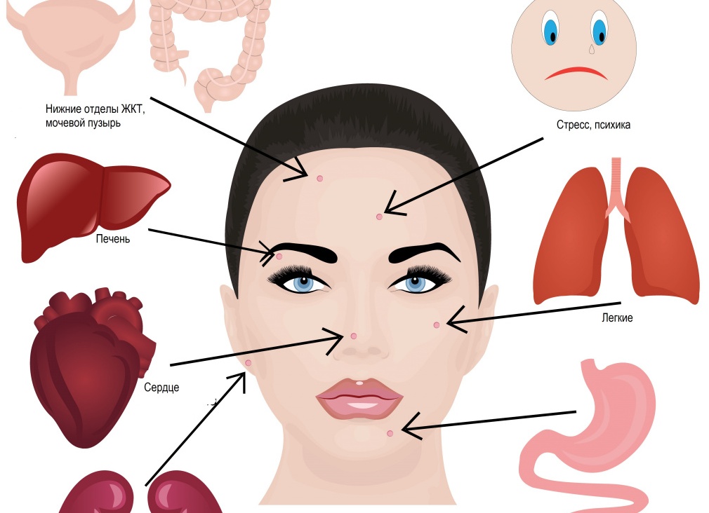 Почему появляются прыщи на подбородке и как от них избавиться