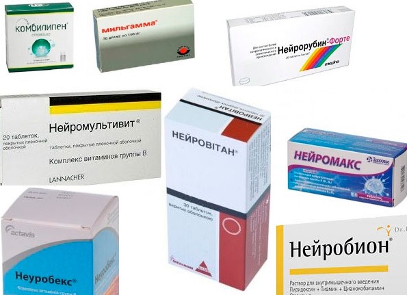 Лечение воспаления седалищного нерва препаратами и народными средствами