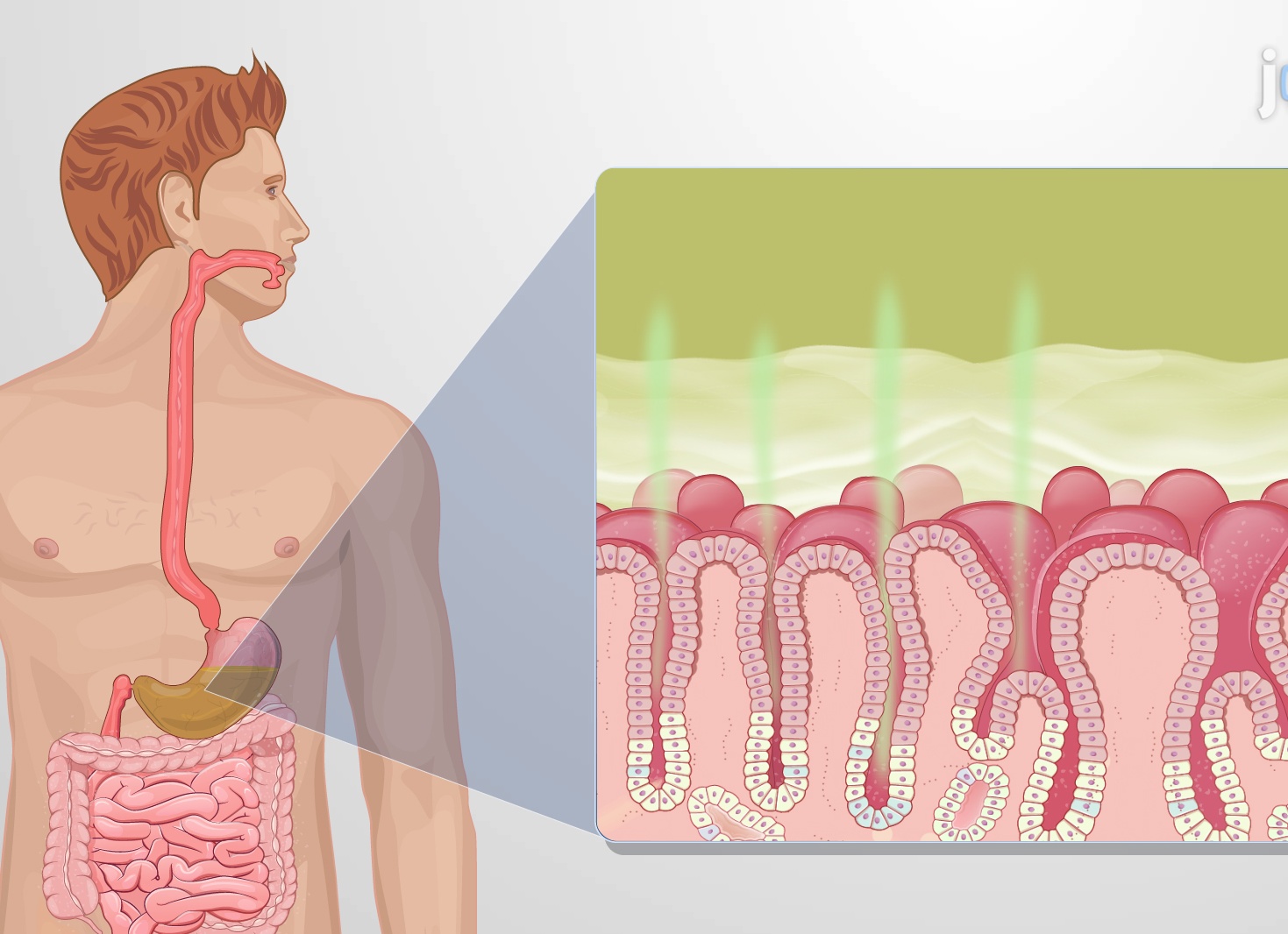 Хеликобактер пилори: симптомы заражения, методы лечения детей и взрослых Хеликобактер пилори: симптомы заражения, методы лечения детей и взрослых
