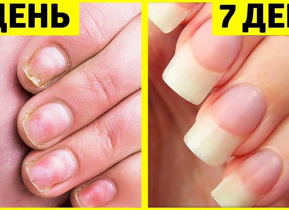 Как отрастить длинные ногти за неделю в домашних условиях Как отрастить длинные ногти за неделю в домашних условиях