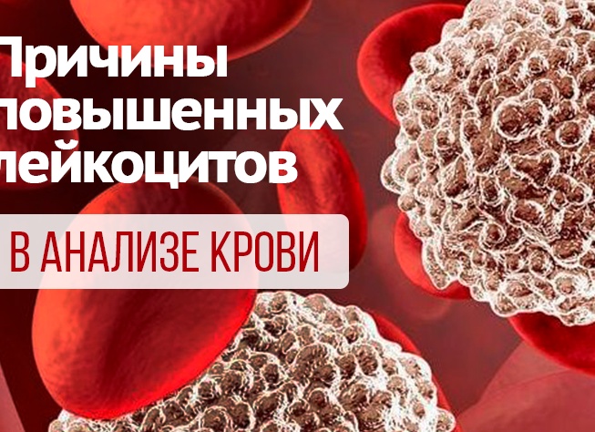 Почему повышены лейкоциты в крови и как привести их в норму Почему повышены лейкоциты в крови и как привести их в норму