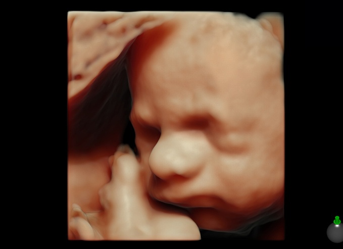 Что происходит на 30 неделе беременности с малышом и будущей мамой