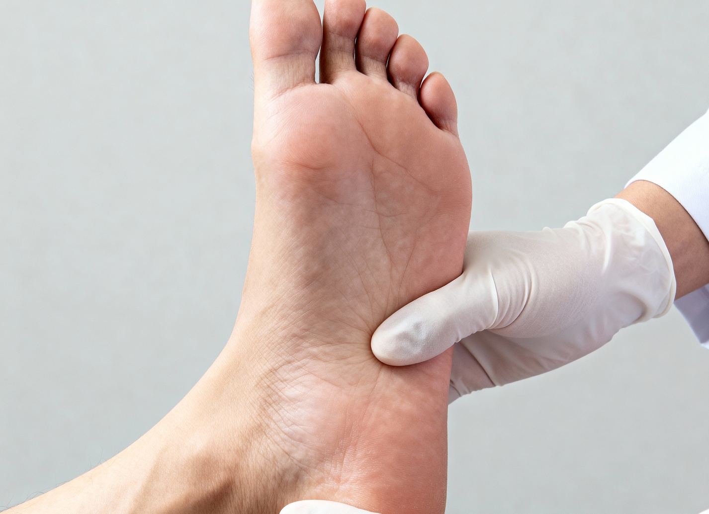 Лечение подошвенной бородавки в домашних условиях