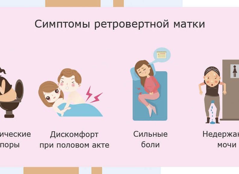 Загиб шейки матки: симптомы, причины и последствия Загиб шейки матки: симптомы, причины и последствия