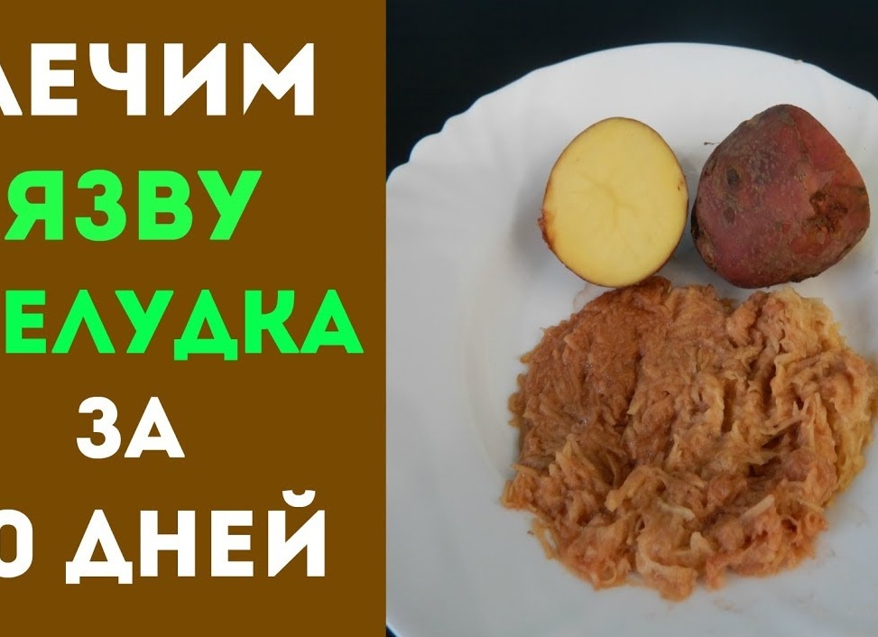 Как вылечить язву желудка медикаментами и народными средствами Как вылечить язву желудка медикаментами и народными средствами