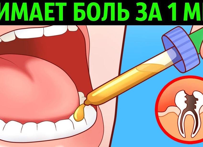 Чем можно снять зубную боль в домашних условиях