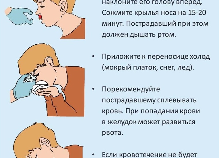 Что делать, если часто идет кровь из носа Что делать, если часто идет кровь из носа