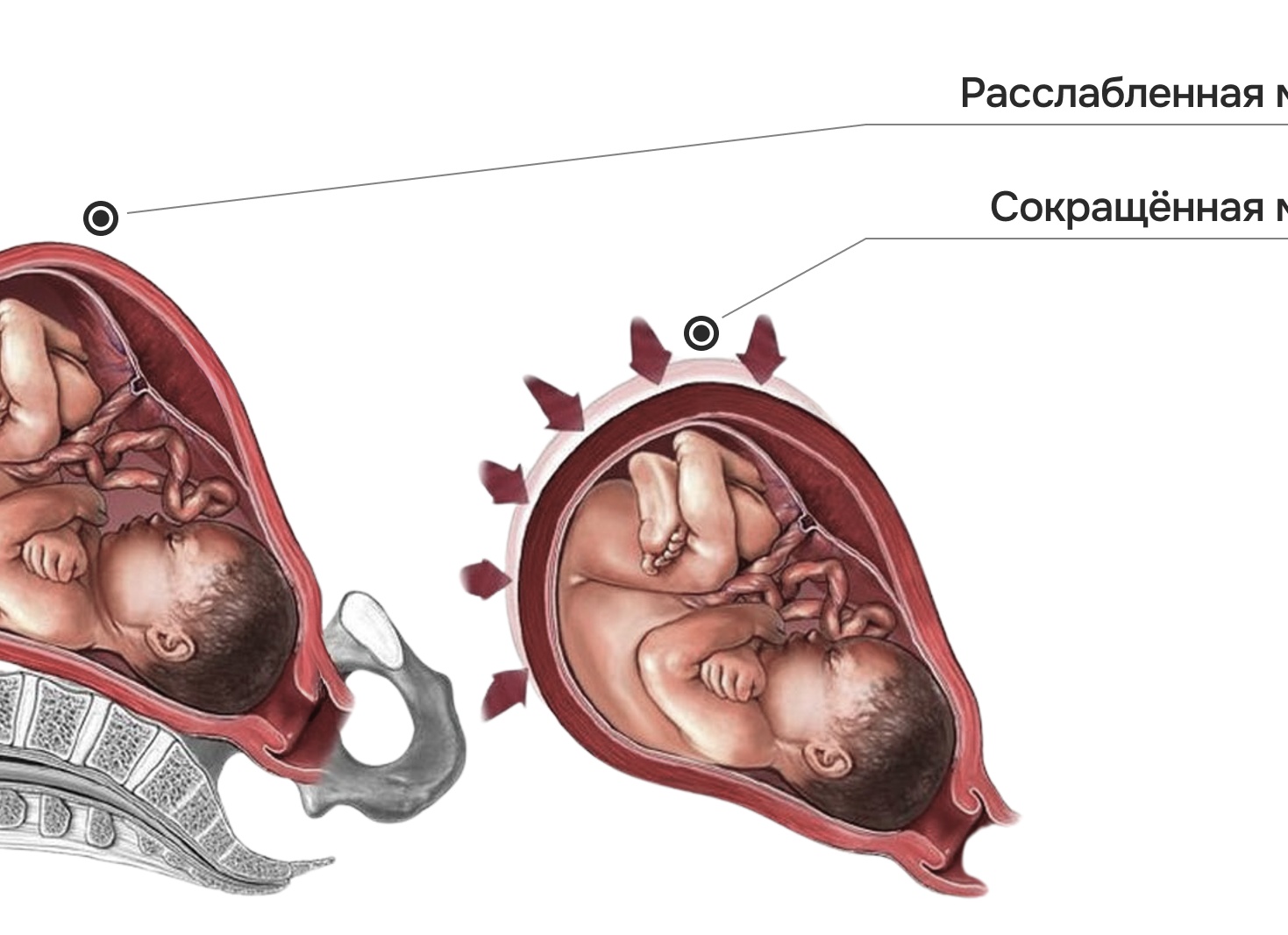 Почему повышается тонус матки у беременных и как скорректировать такое состояние