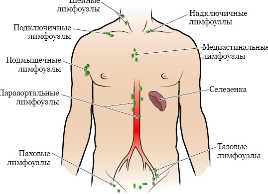 Где находятся лимфоузлы у человека и как за ними следить Где находятся лимфоузлы у человека и как за ними следить