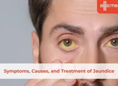 Причины возникновения и лечение желтушки у новорожденных Причины возникновения и лечение желтушки у новорожденных