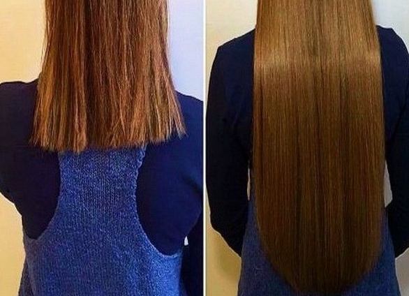 Как можно ускорить рост волос в домашних условиях