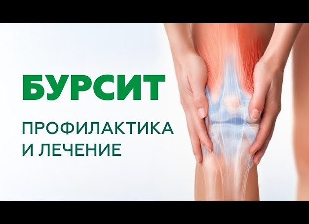 Как лечить бурсит коленного сустава в домашних условиях