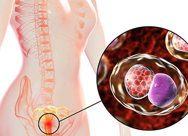 Признаки появления хламидий у женщин и способы лечения