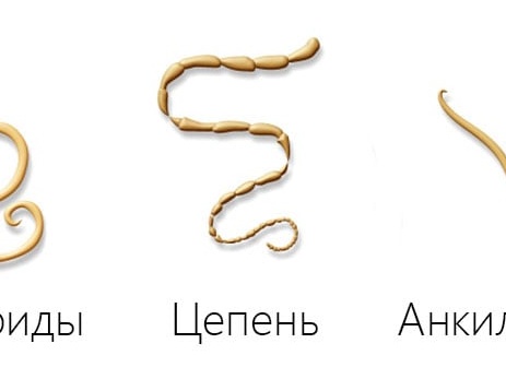 Признаки и способы выведения глистов у взрослого человека Признаки и способы выведения глистов у взрослого человека