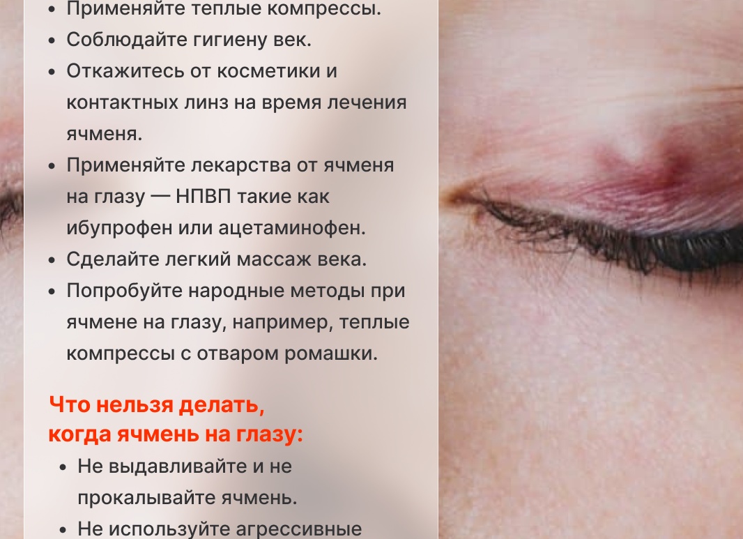 Как лечить ячмень на глазу в домашних условиях Как лечить ячмень на глазу в домашних условиях