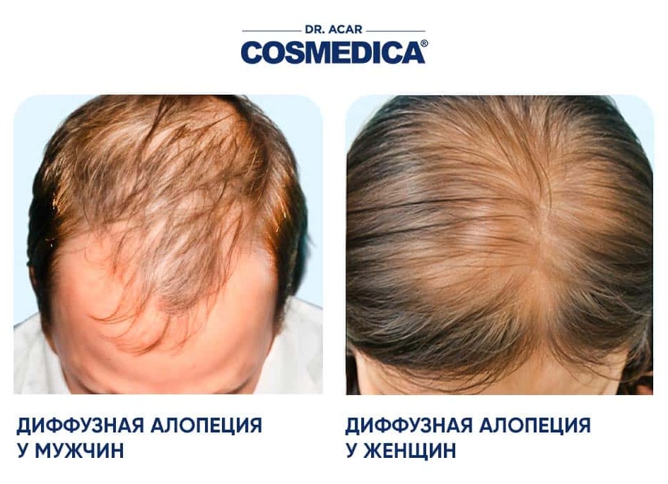 Способы завивки волос на длительное время Способы завивки волос на длительное время