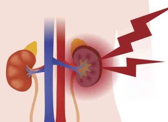 Симптомы и лечение хронической почечной недостаточности Симптомы и лечение хронической почечной недостаточности