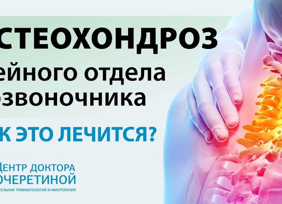 Как лечить остеохондроз шейного отдела позвоночника
