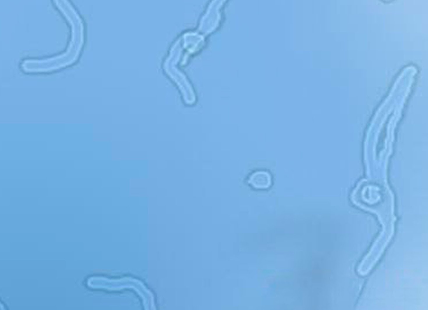 Почему появляются мушки перед глазами и как от них избавиться Почему появляются мушки перед глазами и как от них избавиться