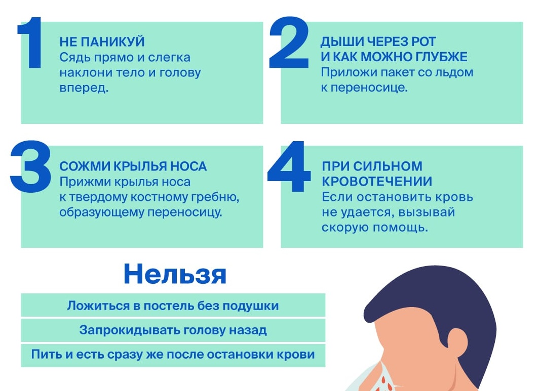 Как правильно остановить кровь из носа у ребенка и взрослого человека Как правильно остановить кровь из носа у ребенка и взрослого человека