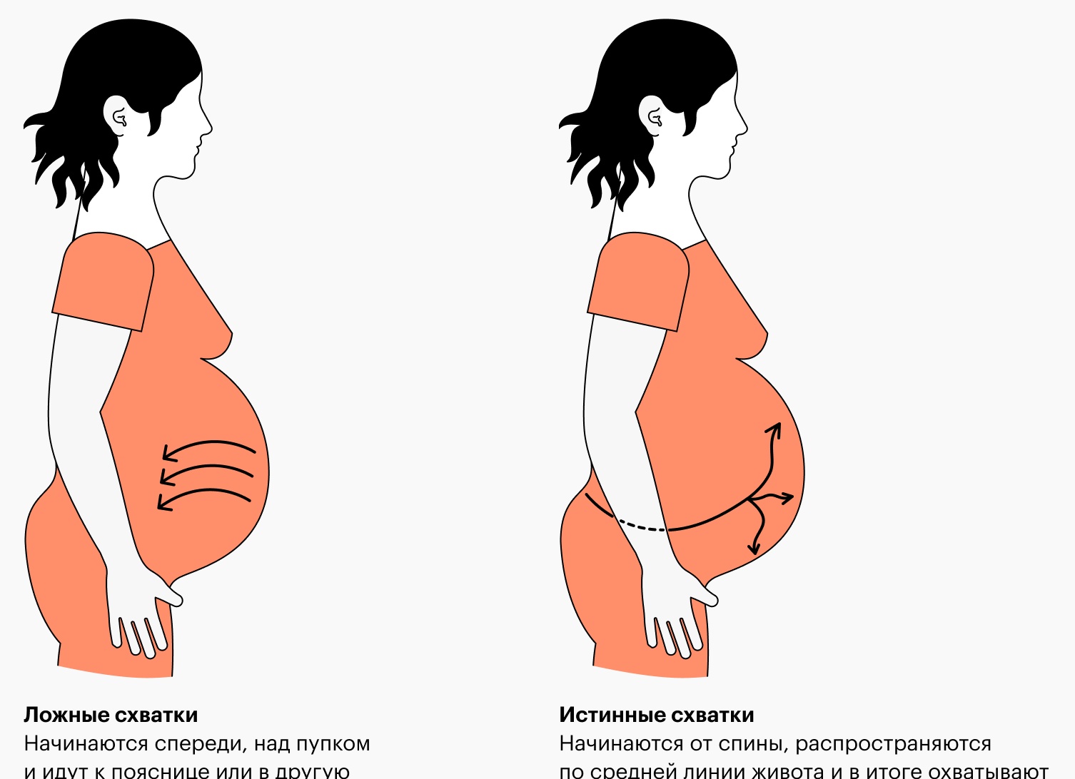 Как проявляются ложные схватки при беременности Как проявляются ложные схватки при беременности