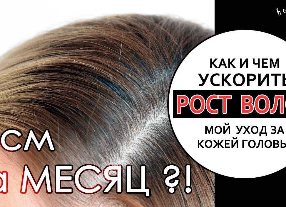 Как ускорить рост волос на голове: маски, шампуни, домашние средства Как ускорить рост волос на голове: маски, шампуни, домашние средства