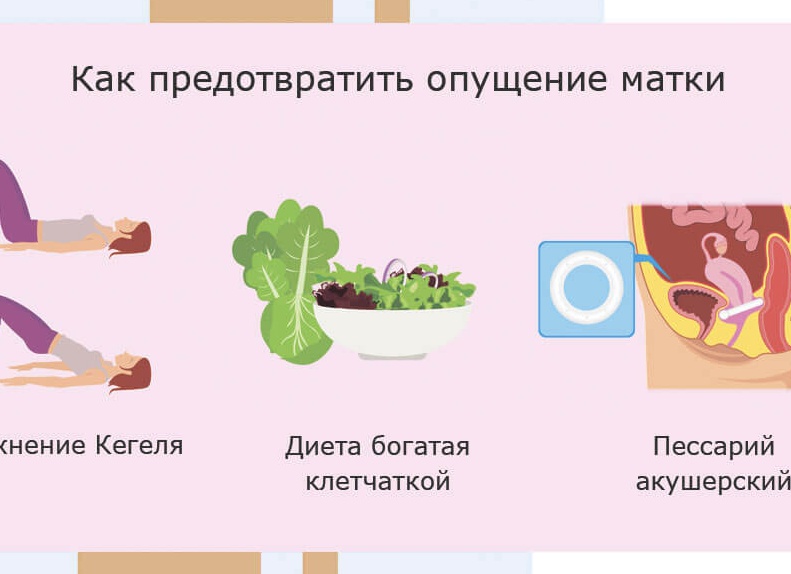 Как лечить опущение шейки матки в домашних условиях Как лечить опущение шейки матки в домашних условиях